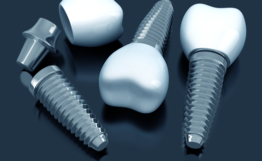 Dental Implants